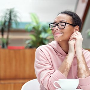 Woman with vitiligo indoor dressed pink hoodie sitting on the table