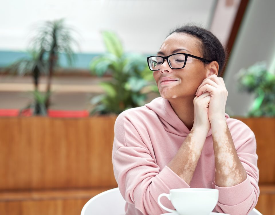 Woman with vitiligo indoor dressed pink hoodie sitting on the table