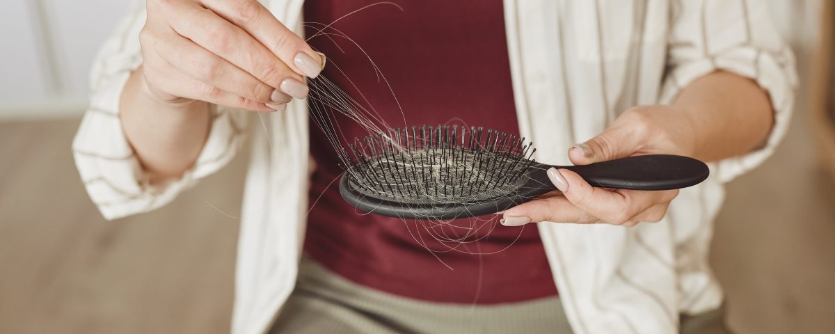 Woman have hair loss problems and holds a comb with hair falling out in her hand
